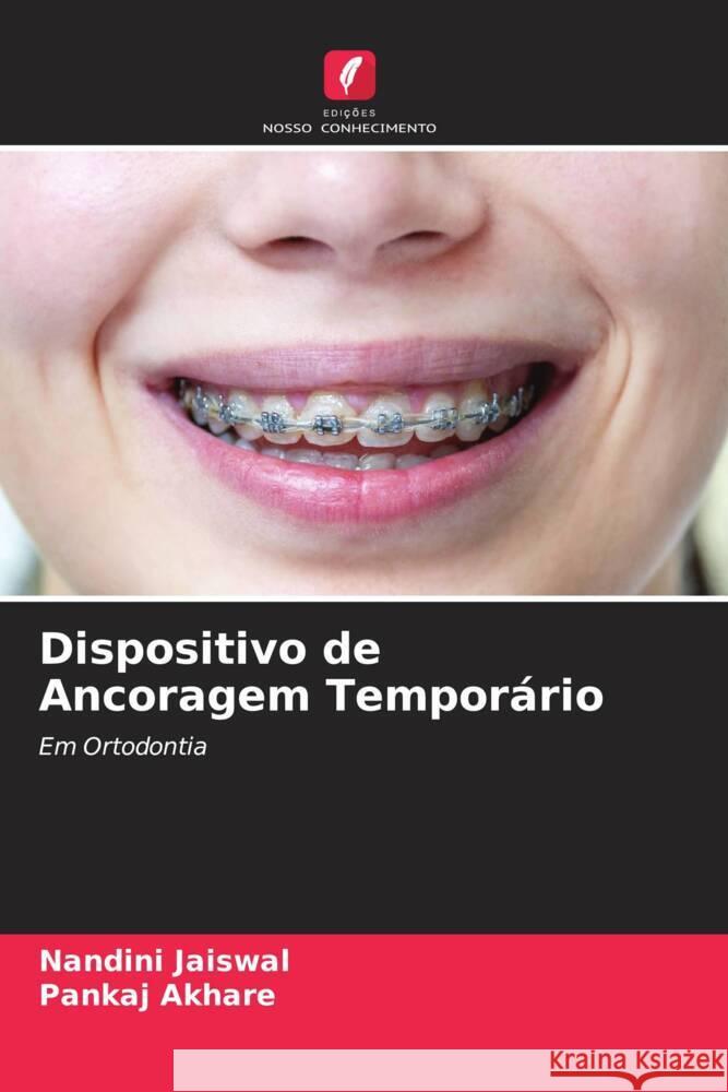 Dispositivo de Ancoragem Temporário Jaiswal, Nandini, Akhare, Pankaj 9786204614212