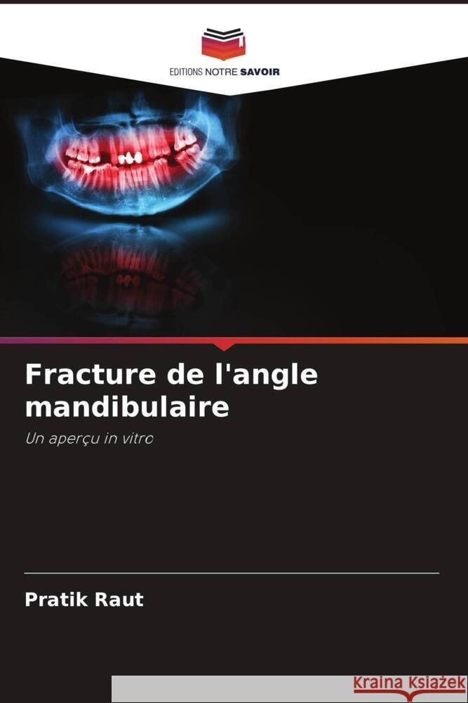 Fracture de l'angle mandibulaire Raut, Pratik 9786204615257