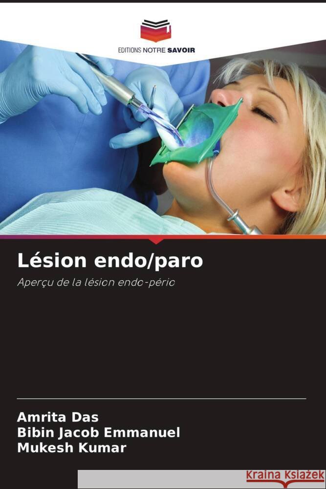Lésion endo/paro Das, Amrita, Emmanuel, Bibin Jacob, Kumar, Mukesh 9786204618180 Editions Notre Savoir