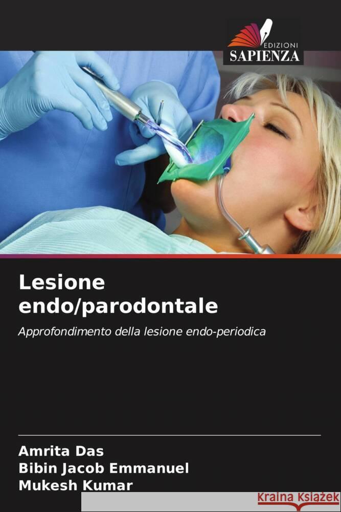 Lesione endo/parodontale Das, Amrita, Emmanuel, Bibin Jacob, Kumar, Mukesh 9786204618197 Edizioni Sapienza