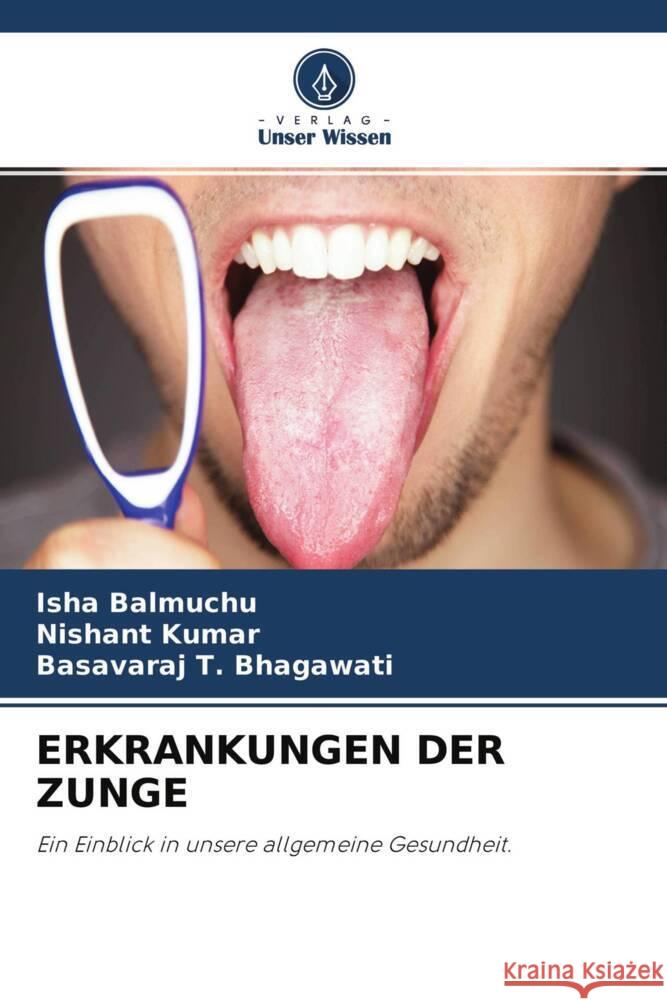 ERKRANKUNGEN DER ZUNGE Balmuchu, Isha, Kumar, Nishant, Bhagawati, Basavaraj T. 9786204622477