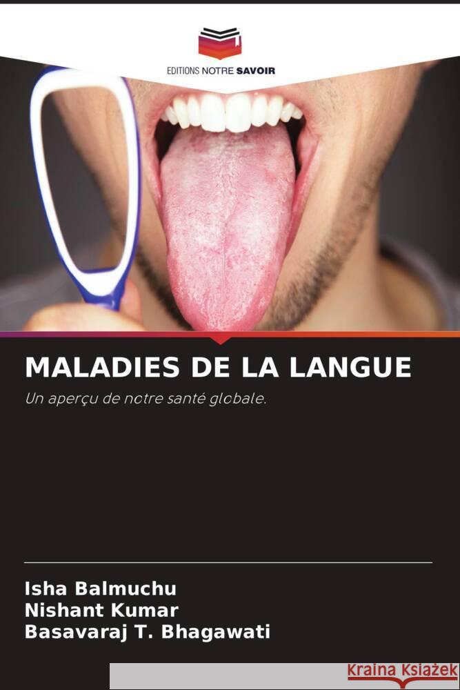 MALADIES DE LA LANGUE Balmuchu, Isha, Kumar, Nishant, Bhagawati, Basavaraj T. 9786204622552