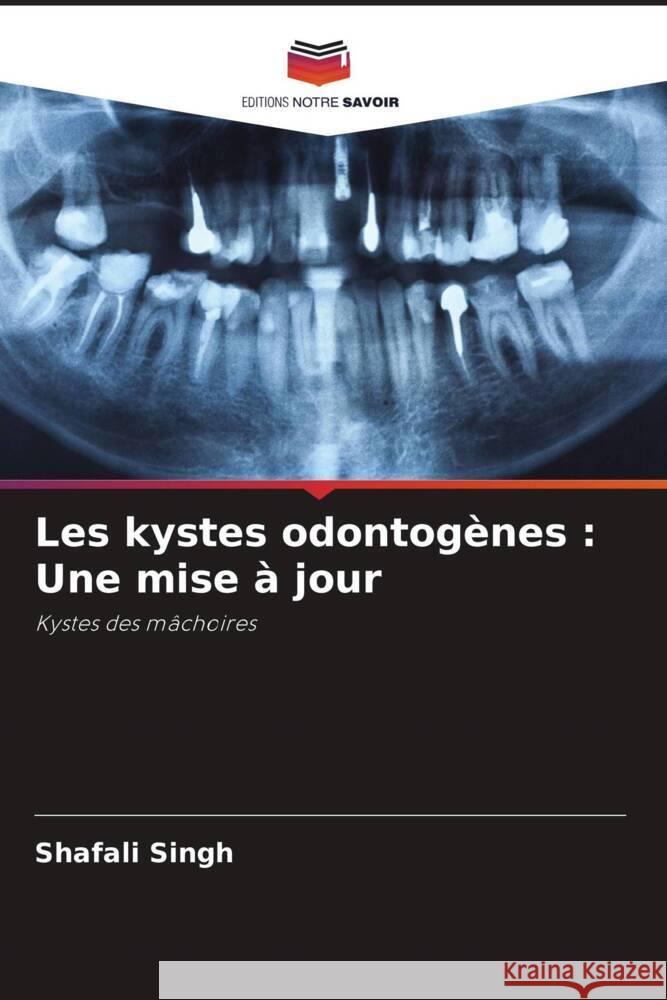 Les kystes odontogènes : Une mise à jour Singh, Shafali 9786204625638