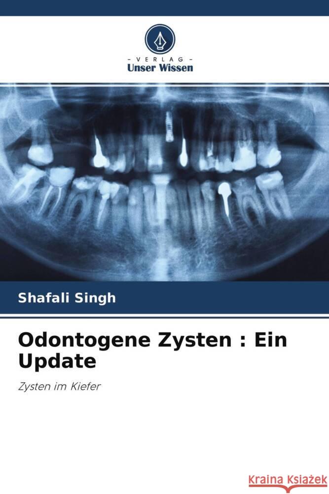 Odontogene Zysten : Ein Update Singh, Shafali 9786204625669