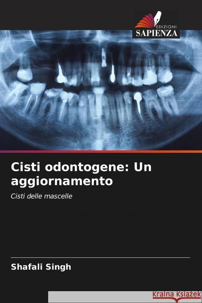 Cisti odontogene: Un aggiornamento Singh, Shafali 9786204625881