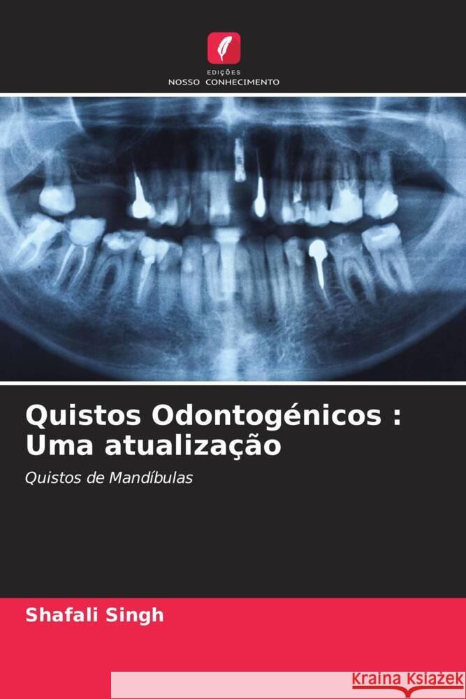 Quistos Odontogénicos : Uma atualização Singh, Shafali 9786204625898