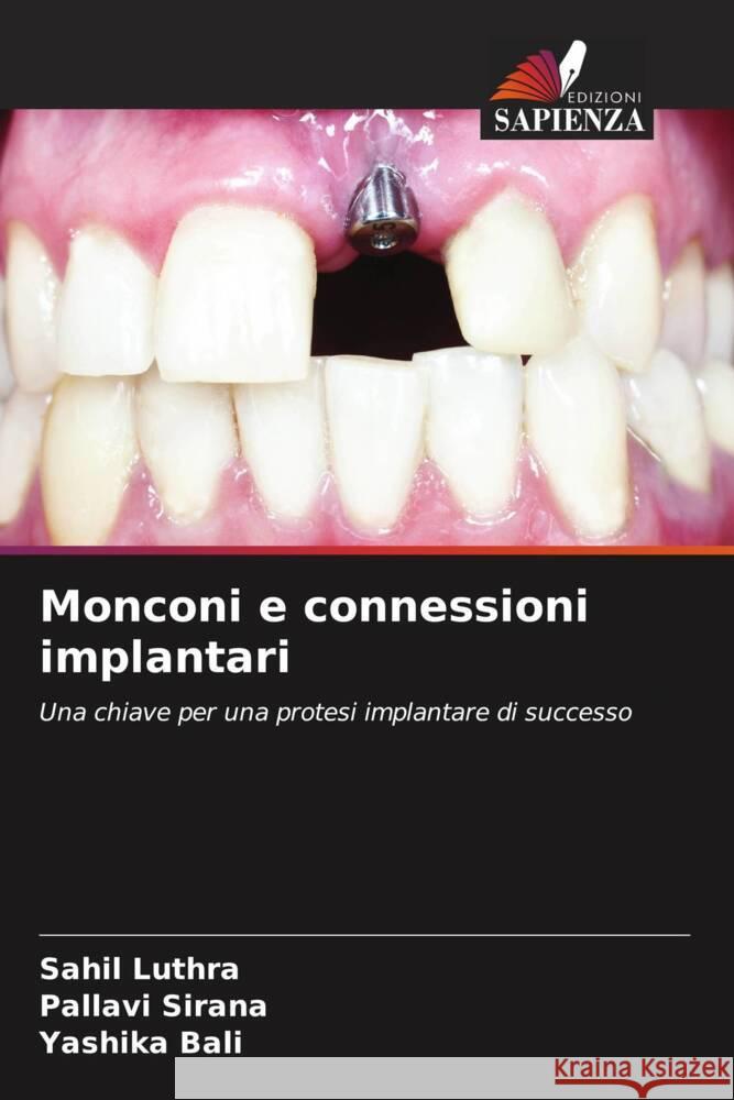 Monconi e connessioni implantari Luthra, Sahil, Sirana, Pallavi, Bali, Yashika 9786204629193