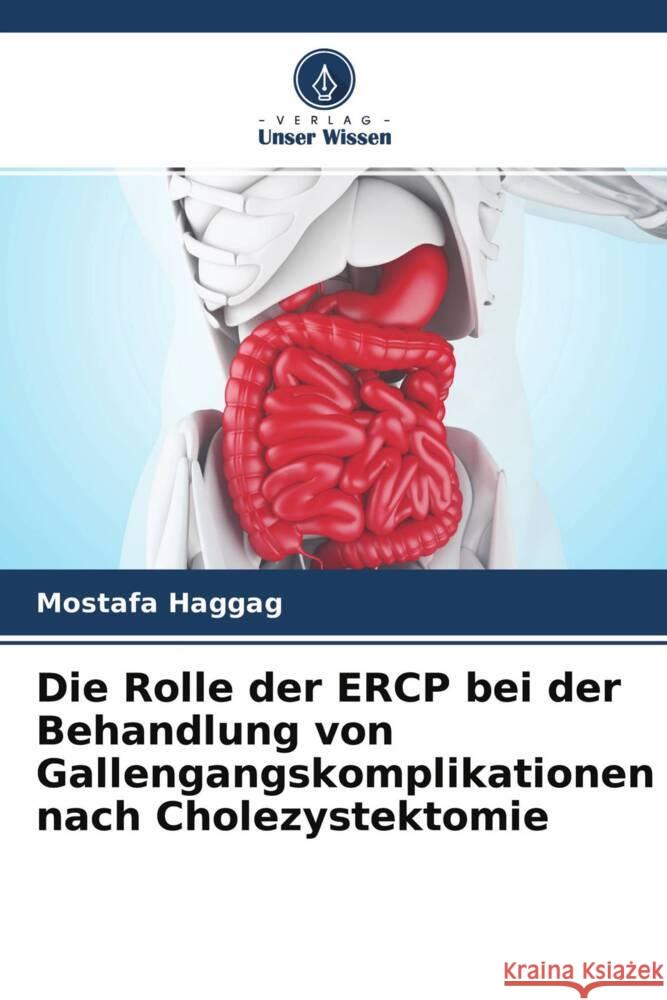 Die Rolle der ERCP bei der Behandlung von Gallengangskomplikationen nach Cholezystektomie Haggag, Mostafa 9786204638065