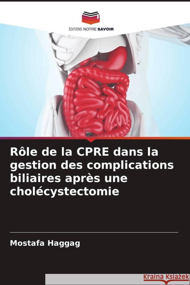 Rôle de la CPRE dans la gestion des complications biliaires après une cholécystectomie Haggag, Mostafa 9786204638089