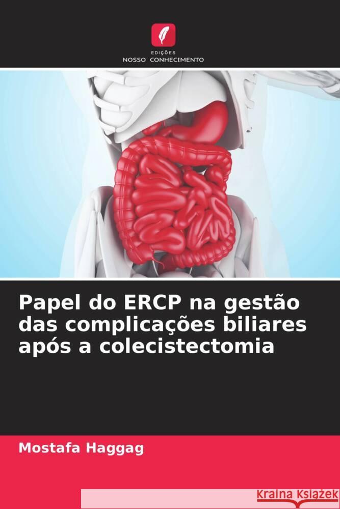 Papel do ERCP na gestão das complicações biliares após a colecistectomia Haggag, Mostafa 9786204638102