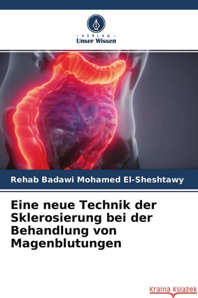 Eine neue Technik der Sklerosierung bei der Behandlung von Magenblutungen El-Sheshtawy, Rehab Badawi Mohamed 9786204641591