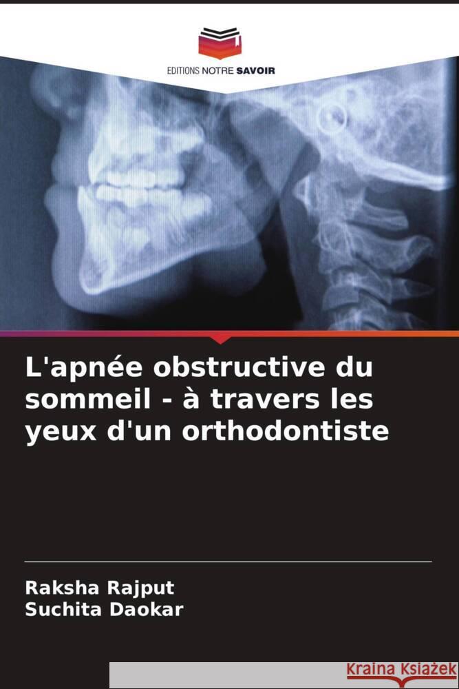 L'apnée obstructive du sommeil - à travers les yeux d'un orthodontiste Rajput, Raksha, Daokar, Suchita 9786204646268