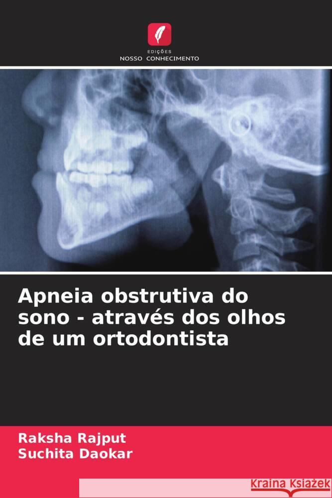 Apneia obstrutiva do sono - através dos olhos de um ortodontista Rajput, Raksha, Daokar, Suchita 9786204646282