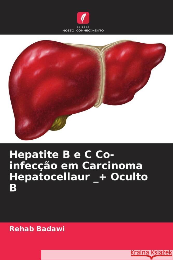 Hepatite B e C Co-infecção em Carcinoma Hepatocellaur _+ Oculto B Badawi, Rehab 9786204649672