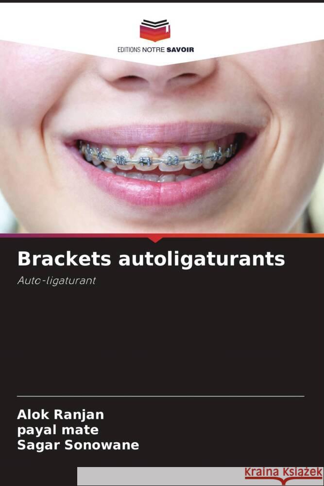 Brackets autoligaturants Ranjan, Alok, mate, payal, Sonowane, Sagar 9786204651620 Editions Notre Savoir