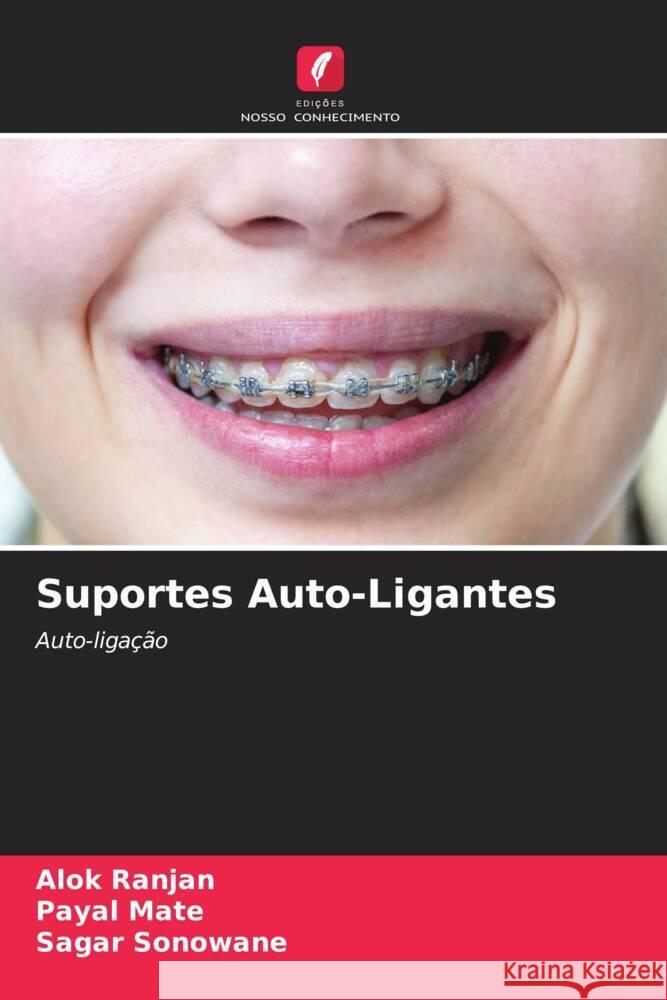 Suportes Auto-Ligantes Ranjan, Alok, mate, payal, Sonowane, Sagar 9786204651644 Edições Nosso Conhecimento