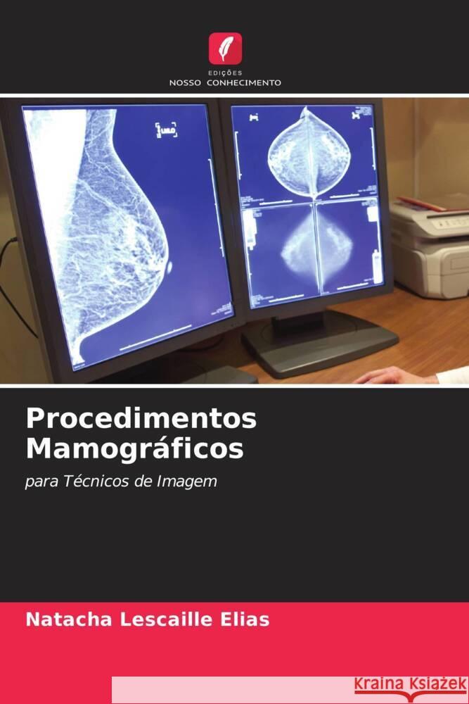 Procedimentos Mamográficos Lescaille Elias, Natacha 9786204652665 Edições Nosso Conhecimento