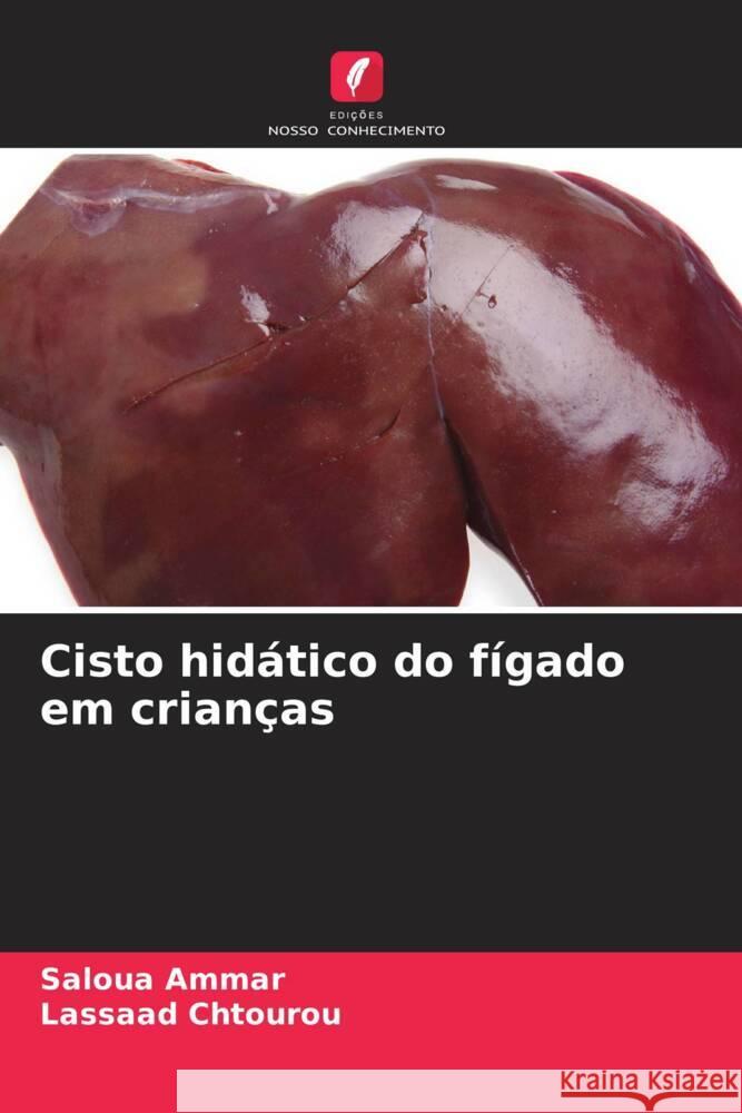 Cisto hidático do fígado em crianças Ammar, Saloua, Chtourou, Lassaad 9786204658216