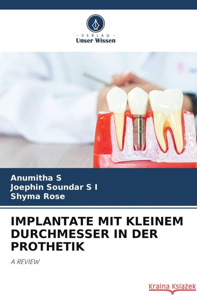 IMPLANTATE MIT KLEINEM DURCHMESSER IN DER PROTHETIK S, Anumitha, S I, Joephin Soundar, Rose, Shyma 9786204659053