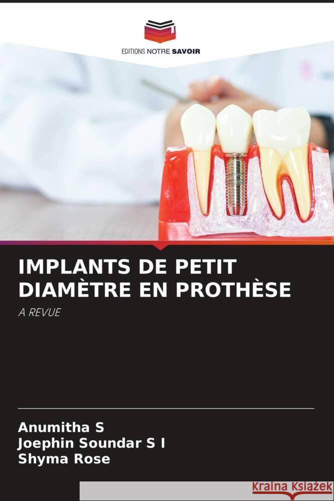 IMPLANTS DE PETIT DIAMÈTRE EN PROTHÈSE S, Anumitha, S I, Joephin Soundar, Rose, Shyma 9786204659084