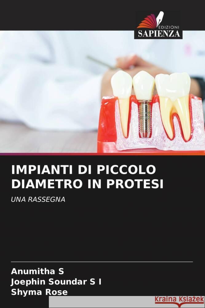 IMPIANTI DI PICCOLO DIAMETRO IN PROTESI S, Anumitha, S I, Joephin Soundar, Rose, Shyma 9786204659091