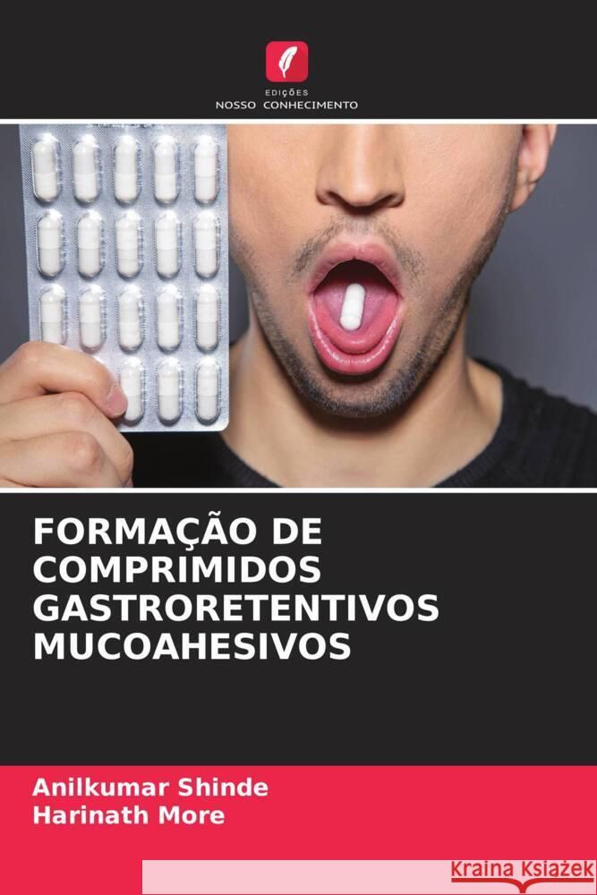 FORMAÇÃO DE COMPRIMIDOS GASTRORETENTIVOS MUCOAHESIVOS Shinde, Anilkumar, More, Harinath 9786204661919 Edições Nosso Conhecimento