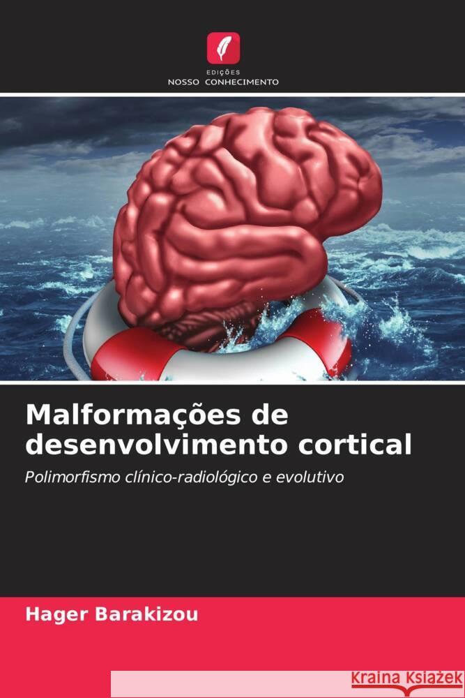 Malformações de desenvolvimento cortical Barakizou, Hager 9786204665955