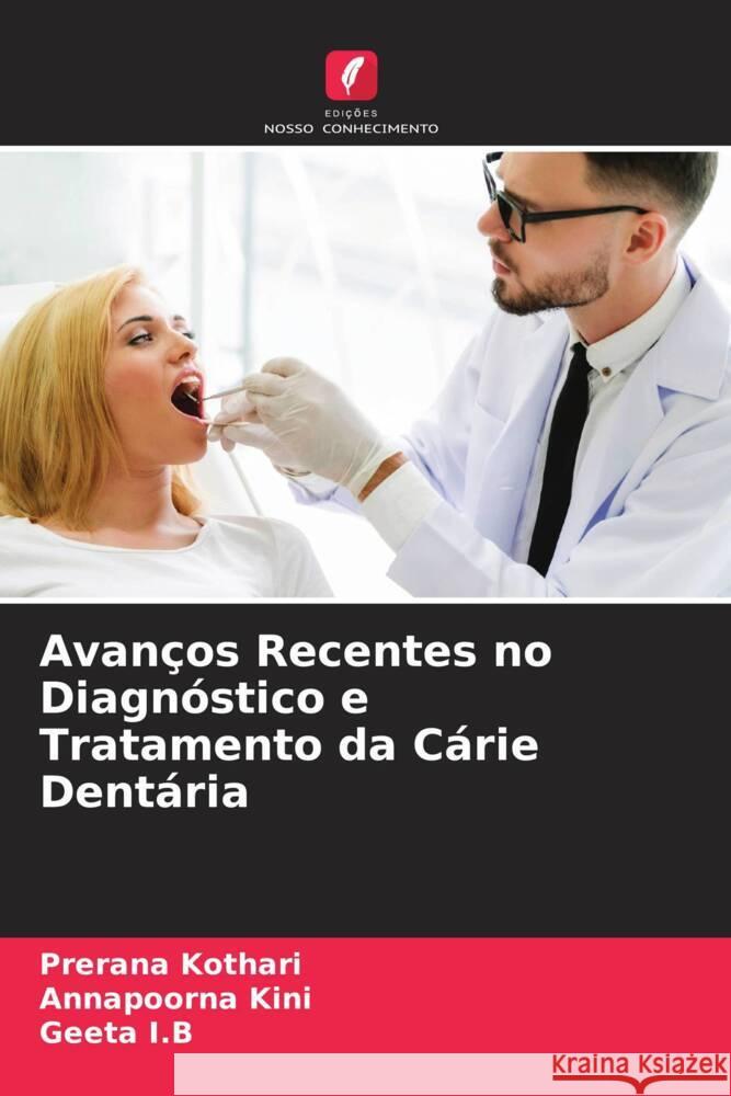 Avan?os Recentes no Diagn?stico e Tratamento da C?rie Dent?ria Prerana Kothari Annapoorna Kini Geeta I 9786204673660 Edicoes Nosso Conhecimento