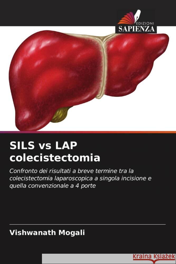 SILS vs LAP colecistectomia Mogali, Vishwanath 9786204673752 Edizioni Sapienza