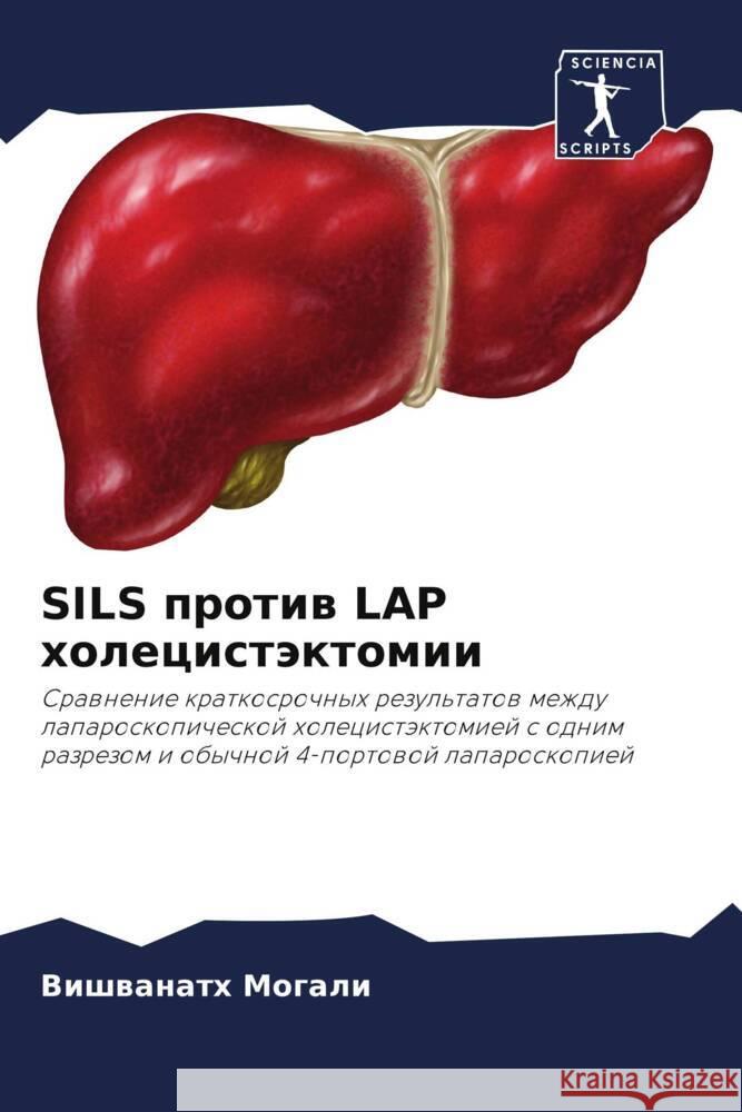 SILS protiw LAP holecistäktomii Mogali, Vishwanath 9786204673820 Sciencia Scripts