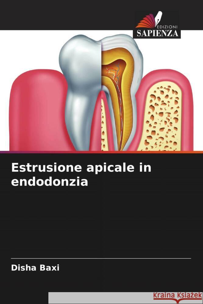 Estrusione apicale in endodonzia Baxi, Disha 9786204677804