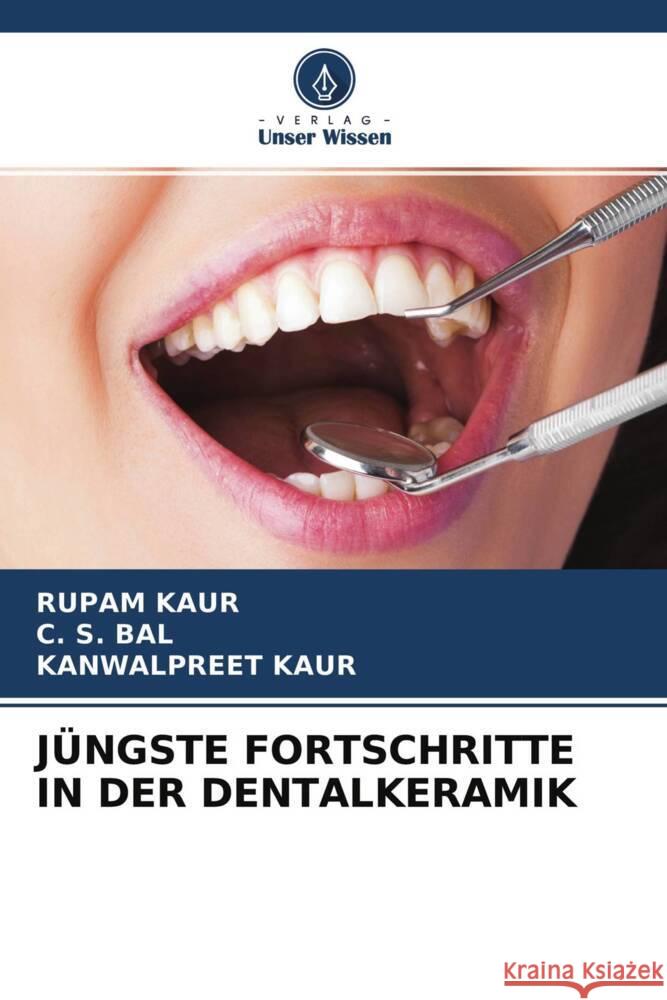 JÜNGSTE FORTSCHRITTE IN DER DENTALKERAMIK kaur, Rupam, Bal, C. S., Kaur, Kanwalpreet 9786204693521