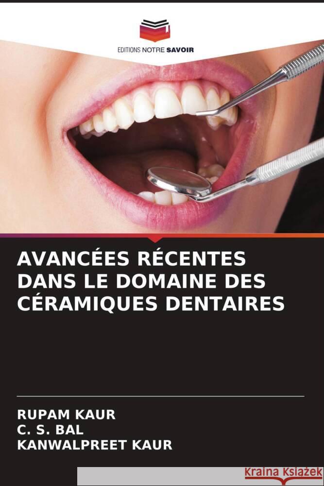 AVANCÉES RÉCENTES DANS LE DOMAINE DES CÉRAMIQUES DENTAIRES kaur, Rupam, Bal, C. S., Kaur, Kanwalpreet 9786204693569 Editions Notre Savoir