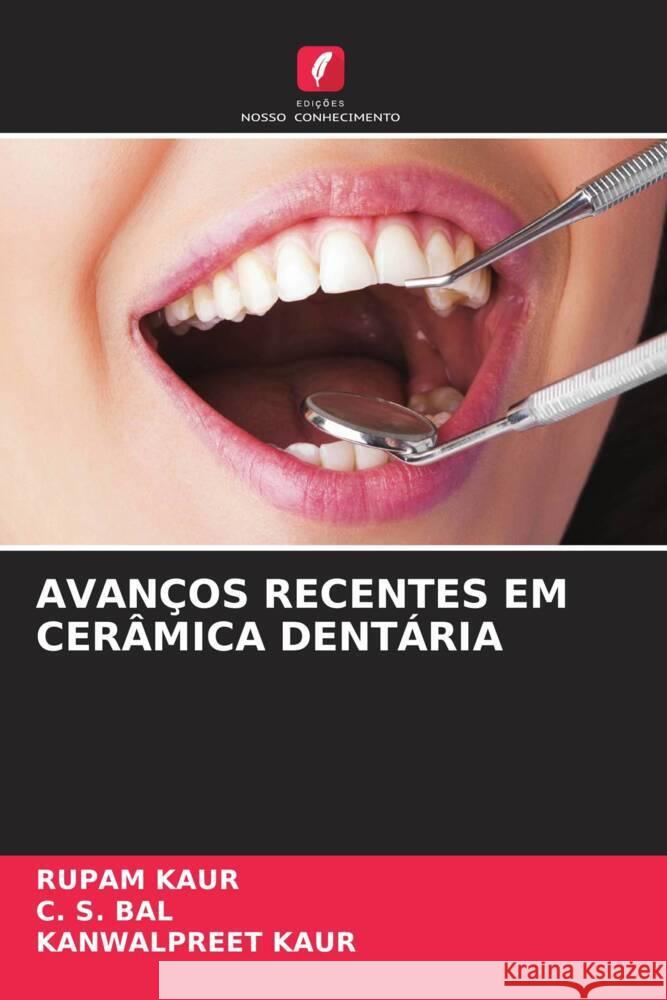 AVANÇOS RECENTES EM CERÂMICA DENTÁRIA kaur, Rupam, Bal, C. S., Kaur, Kanwalpreet 9786204693583 Edições Nosso Conhecimento