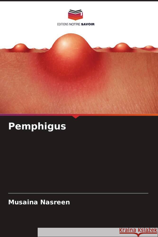 Pemphigus Nasreen, Musaina 9786204693620 Editions Notre Savoir