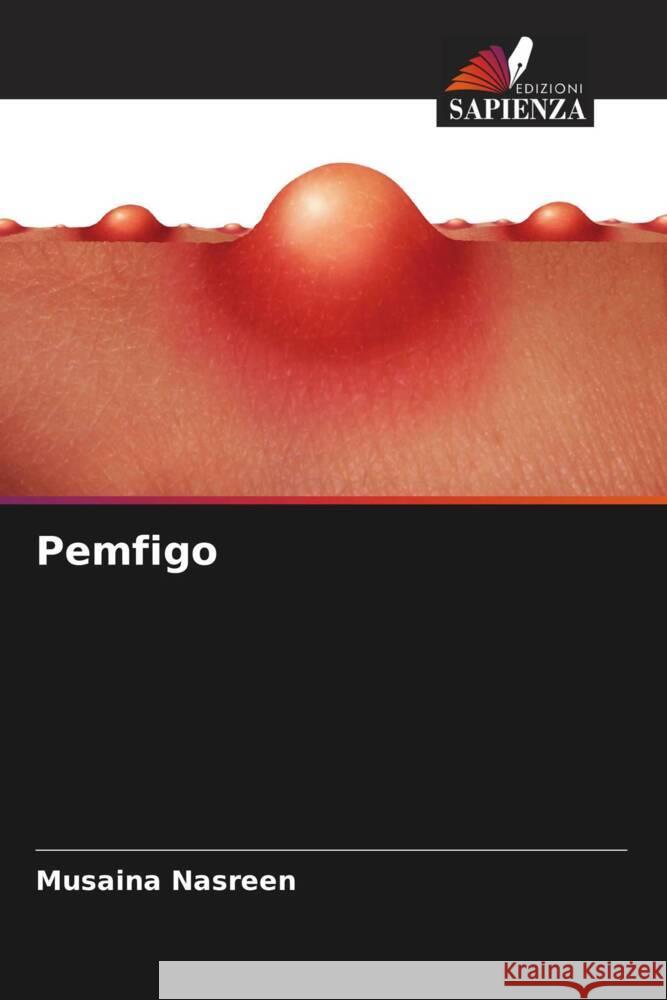 Pemfigo Nasreen, Musaina 9786204693637 Edizioni Sapienza