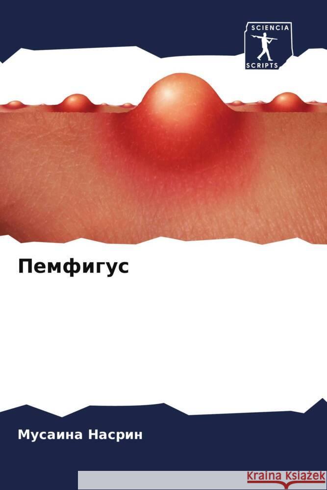 Pemfigus Nasrin, Musaina 9786204693651 Sciencia Scripts