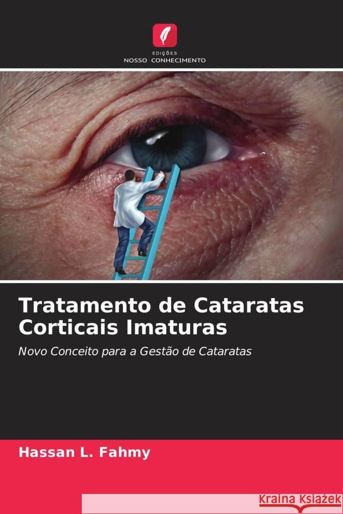 Tratamento de Cataratas Corticais Imaturas L. Fahmy, Hassan 9786204694856 Edições Nosso Conhecimento