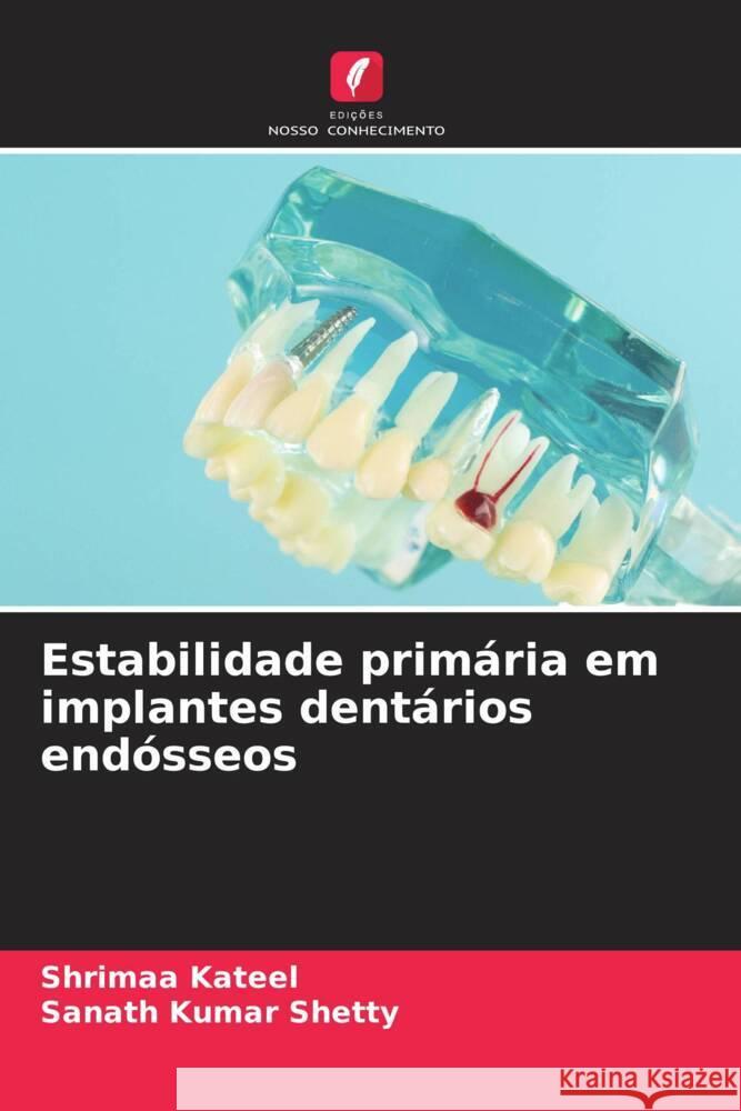 Estabilidade primária em implantes dentários endósseos Kateel, Shrimaa, Shetty, Sanath Kumar 9786204696348