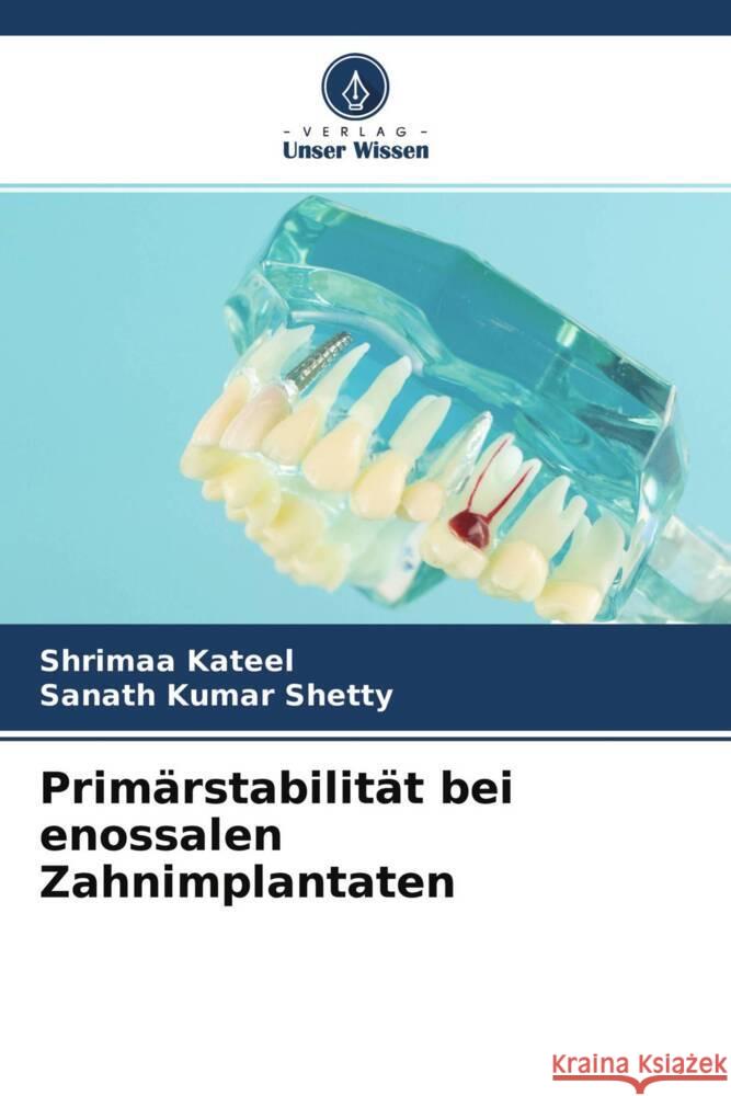 Primärstabilität bei enossalen Zahnimplantaten Kateel, Shrimaa, Shetty, Sanath Kumar 9786204696355