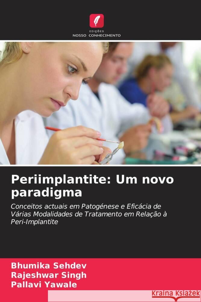 Periimplantite: Um novo paradigma Sehdev, Bhumika, Singh, Rajeshwar, Yawale, Pallavi 9786204696485 Edições Nosso Conhecimento