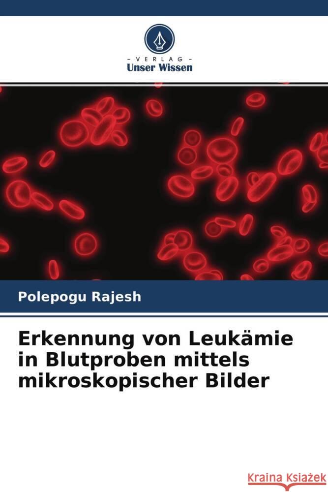 Erkennung von Leukämie in Blutproben mittels mikroskopischer Bilder Rajesh, Polepogu 9786204696935 Verlag Unser Wissen