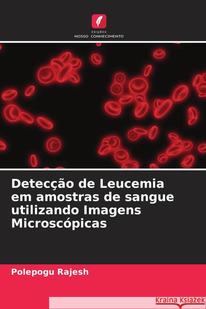 Detecção de Leucemia em amostras de sangue utilizando Imagens Microscópicas Rajesh, Polepogu 9786204696980 Edições Nosso Conhecimento