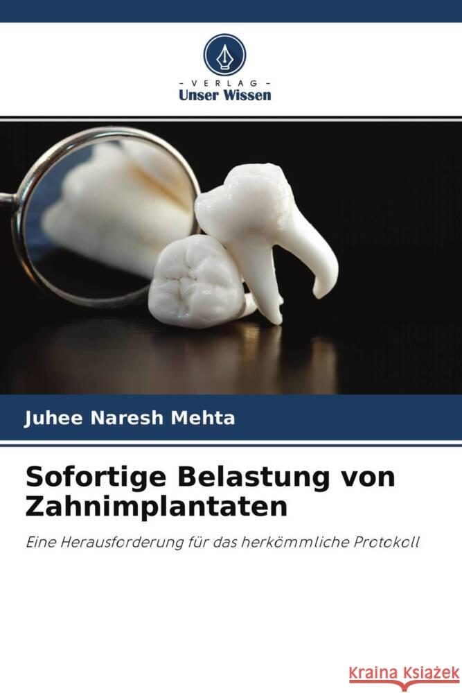 Sofortige Belastung von Zahnimplantaten Mehta, Juhee Naresh 9786204697796