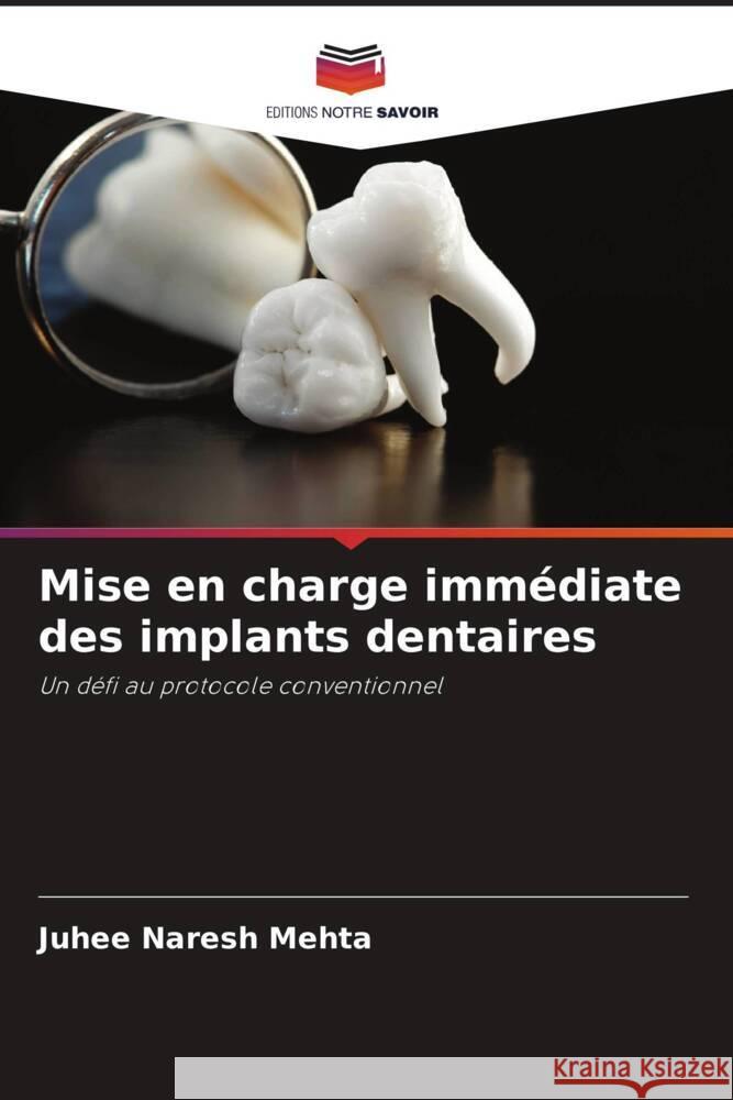 Mise en charge immédiate des implants dentaires Mehta, Juhee Naresh 9786204697819