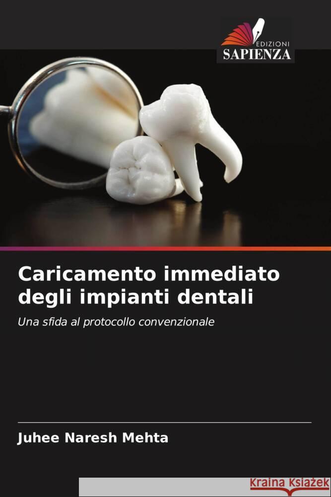 Caricamento immediato degli impianti dentali Mehta, Juhee Naresh 9786204697826