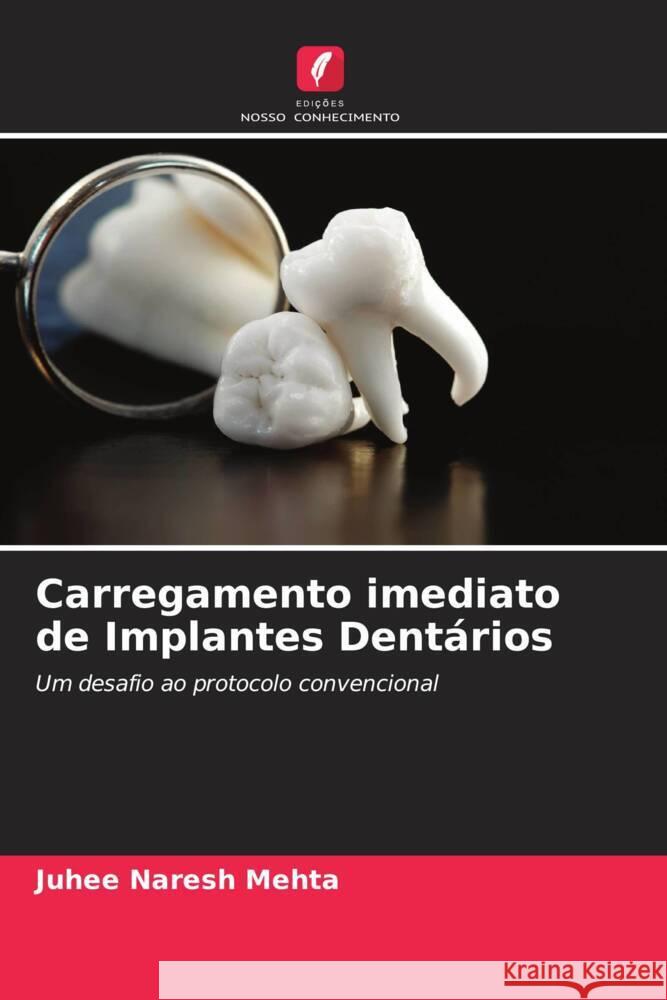 Carregamento imediato de Implantes Dentários Mehta, Juhee Naresh 9786204697833