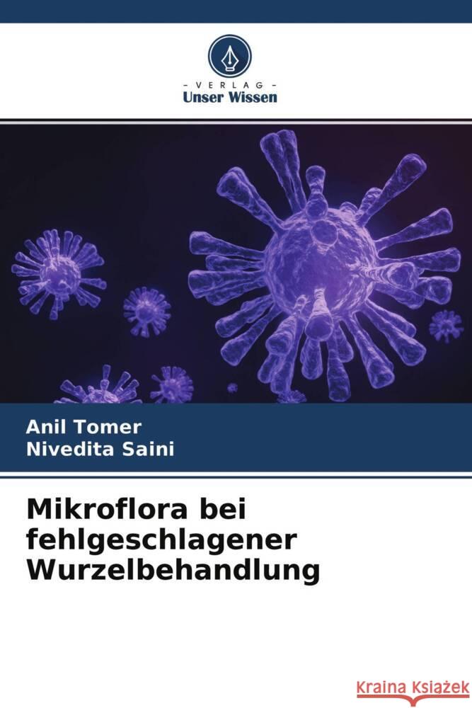 Mikroflora bei fehlgeschlagener Wurzelbehandlung Tomer, Anil, Saini, Nivedita 9786204699646 Verlag Unser Wissen