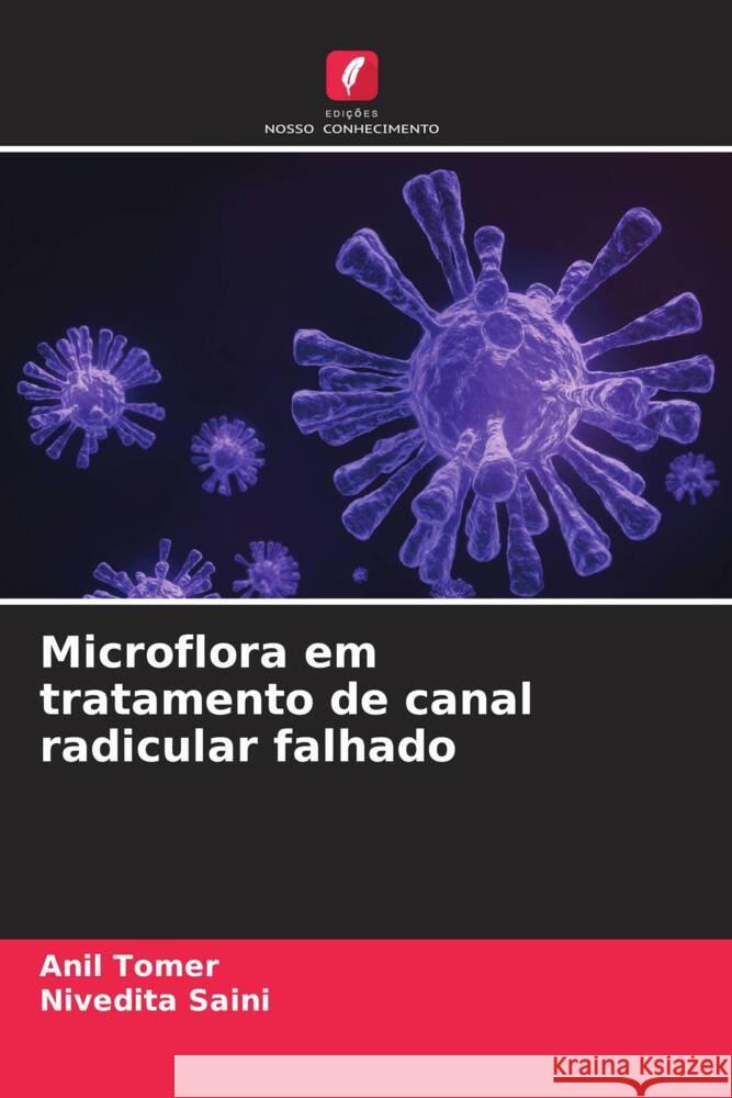 Microflora em tratamento de canal radicular falhado Tomer, Anil, Saini, Nivedita 9786204699684 Edições Nosso Conhecimento