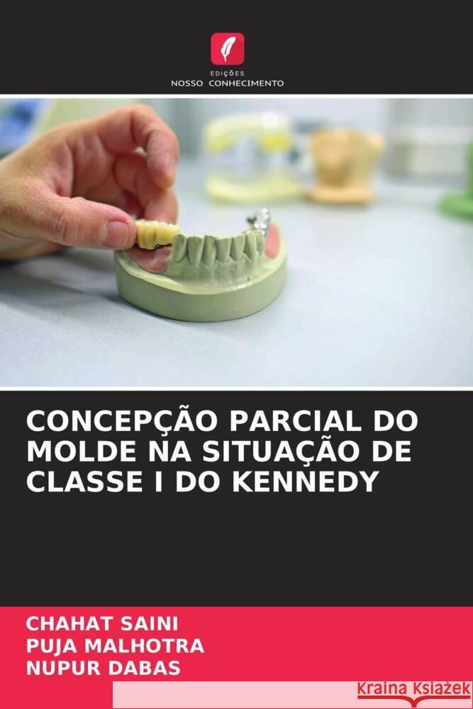 CONCEPÇÃO PARCIAL DO MOLDE NA SITUAÇÃO DE CLASSE I DO KENNEDY SAINI, Chahat, MALHOTRA, Puja, DABAS, Nupur 9786204702155